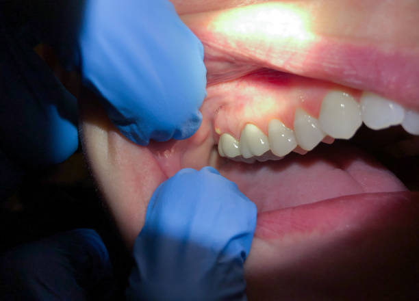 Best Emergency Gum Pain Relief  in Arden Hills, MN