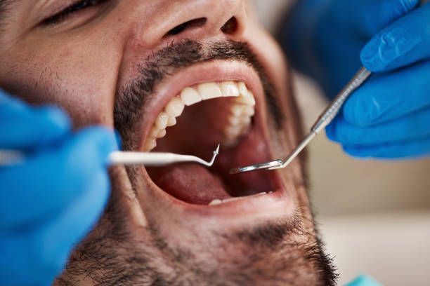 Best Urgent Tooth Repair  in Arden Hills, MN
